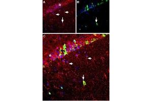 Immunohistochemistry (IHC) image for anti-Glial Cell Line Derived Neurotrophic Factor (GDNF) (AA 192-207), (Mature) antibody (ABIN7043216)