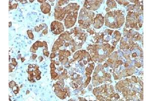IHC testing of FFPE human pituitary gland with ACTH antibody (clone CLIP/1449). (CLIP 抗体  (AA 25-39))