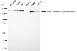 Western blotting analysis using erb-b2 receptor tyrosine kinase 2 antibody (ABIN7800157). (ErbB2/Her2 抗体)