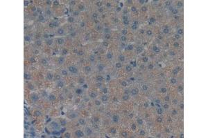 IHC-P analysis of liver tissue, with DAB staining. (TNKS2 抗体  (AA 959-1166))