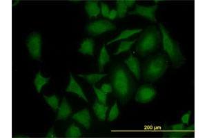 Immunofluorescence of monoclonal antibody to CDK4 on HeLa cell. (CDK4 抗体  (AA 211-303))