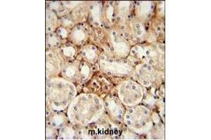 Immunohistochemistry (Paraffin-embedded Sections) (IHC (p)) image for anti-ATP Synthase, H+ Transporting, Mitochondrial Fo Complex, Subunit J2 (ATP5J2) (AA 18-46) antibody (ABIN651539)