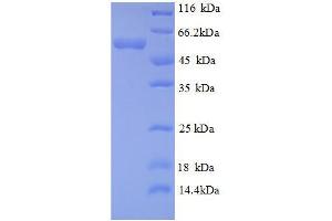Protein expressed in E.