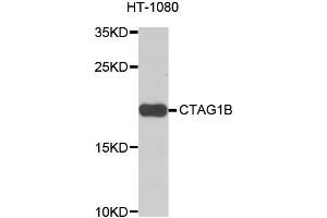 Western blot analysis of extracts of HT-1080 cells, using CTAG1B antibody. (CTAG1B 抗体)