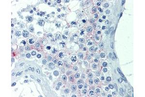 IHC-P Image Immunohistochemical analysis of paraffin-embedded human testis, using EDG7, antibody(20 μg/ml). (LPAR3 抗体)