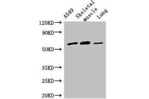 Western Blot Positive WB detected in: A549 whole cell lysate, Mouse skeletal muscle tissue, Rat lung tissue All lanes: AOAH antibody at 2. (AOAH 抗体  (AA 180-254))