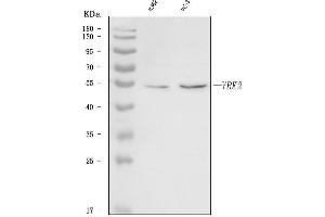 Western blot analysis of VRK2 using anti-VRK2 antibody (ABIN7600420).
