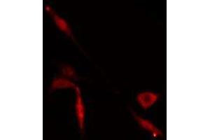 ABIN6274929 staining  Hela cells by IF/ICC. (BAZ2A 抗体  (N-Term))