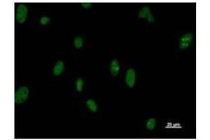 Immunostaining analysis in HeLa cells. (DDX5 抗体)