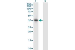 Western Blot analysis of RNF150 expression in transfected 293T cell line by RNF150 monoclonal antibody (M01), clone 5D11. (RNF150 抗体  (AA 67-176))