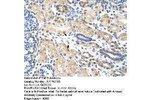 Rabbit Anti-PRMT5 Antibody  Paraffin Embedded Tissue: Human Kidney Cellular Data: Epithelial cells of renal tubule Antibody Concentration: 4. (PRMT5 抗体  (N-Term))