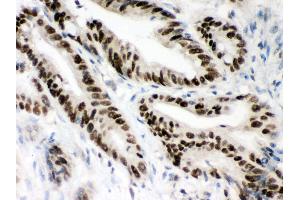 Immunohistochemistry (IHC) image for anti-Mismatch Repair Protein 2 (MSH2) (AA 337-583) antibody (ABIN3043885)