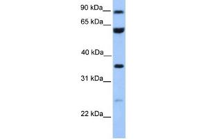 WB Suggested Anti-CCDC7 Antibody Titration: 0. (CCDC7 抗体  (N-Term))