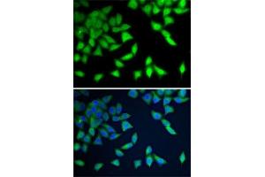 Immunofluorescence analysis of A-549 cells using WDR77 antibody (ABIN6128227, ABIN6150205, ABIN6150206 and ABIN6222948). (WDR77 抗体  (AA 1-260))