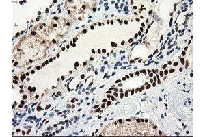 Immunohistochemical staining of paraffin-embedded Human Kidney tissue using anti-NMNAT1 mouse monoclonal antibody. (NMNAT1 抗体)