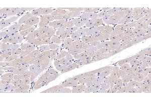 Detection of FKBP1A in Human Cardiac Muscle Tissue using Polyclonal Antibody to FK506 Binding Protein 1A (FKBP1A) (FKBP1A 抗体  (AA 2-108))