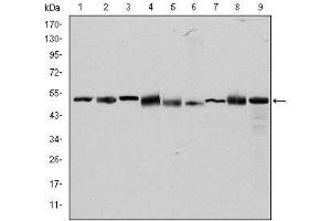 Western blot analysis using CCT2 mouse mAb against Hela (1), MCF-7 (2), Jurkat (3), T47D (4), K562 (5), A431 (6), NIH/3T3 (7), PC-12 (8) and Cos7 (9) cell lysate. (CCT2 抗体)
