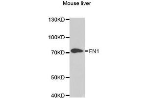 Western blot analysis of extracts of mouse liver, using FN1 antibody. (Fibronectin 1 抗体)
