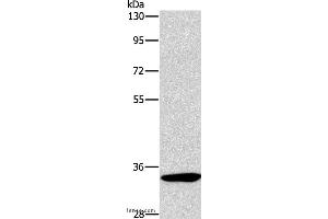 Western blot analysis of Mouse kidney tissue, using NCR1 Polyclonal Antibody at dilution of 1:450 (NCR1 抗体)
