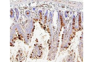 IHC analysis of RAB27A using anti-RAB27A antibody (ABIN7602714).