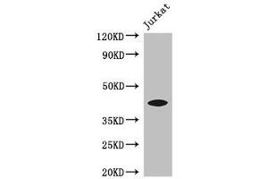 Western Blot Positive WB detected in: Jurkat whole cell lysate All lanes: FOXQ1 antibody at 3 μg/mL Secondary Goat polyclonal to rabbit IgG at 1/50000 dilution Predicted band size: 42 kDa Observed band size: 42 kDa (FOXQ1 抗体  (AA 10-123))