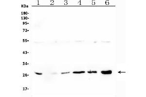Western blot analysis of LRTOMT using anti-LRTOMT antibody (ABIN7602986). (Leucine Rich Transmembrane and 0-Methyltransferase Domain Containing (LRTOMT) (Middle Region) 抗体)