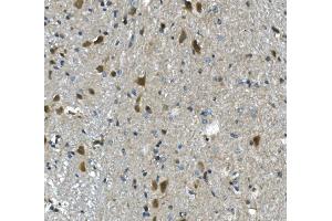 IHC analysis of PAR4/Pawr using anti-PAR4/Pawr antibody (ABIN7599938).