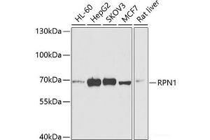 Western blot analysis of extracts of various cell lines using RPN1 Polyclonal Antibody at dilution of 1:1000. (RPN1 抗体)