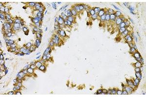 Immunohistochemistry of paraffin-embedded Human prostate using EFNA1 Polyclonal Antibody at dilution of 1:100 (40x lens). (Ephrin A1 抗体)