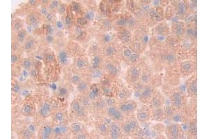 Detection of gp130 in Mouse Liver Tissue using Polyclonal Antibody to Glycoprotein 130 (gp130) (CD130/gp130 抗体  (AA 238-500))