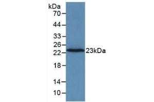 Detection of Recombinant F2, Rat using Monoclonal Antibody to Coagulation Factor II (F2) (Prothrombin 抗体  (AA 44-200))