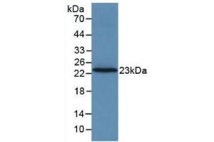 Detection of Recombinant F2, Rat using Monoclonal Antibody to Coagulation Factor II (F2)