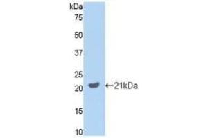 Detection of Recombinant GAS6, Mouse using Polyclonal Antibody to Growth Arrest Specific Protein 6 (GAS6) (GAS6 抗体  (AA 483-646))