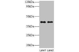 Western blot All lanes: QPCT antibody at 2 μg/mL Lane 1: Rat muscle tissue Lane 2: Rat adrenal gland tissue Secondary Goat polyclonal to rabbit IgG at 1/10000 dilution Predicted band size: 41, 36 kDa Observed band size: 41 kDa (QPCT 抗体  (AA 29-361))
