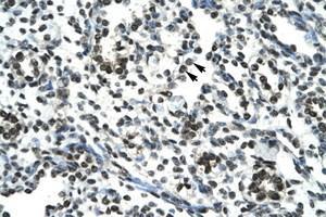 Image no. 1 for anti-Sirtuin 5 (SIRT5) (AA 184-233) antibody (ABIN202189) (SIRT5 抗体  (AA 184-233))