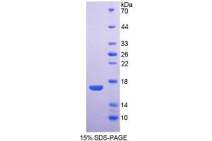 SDS-PAGE analysis of Rabbit AQP1 Protein. (Aquaporin 1 蛋白)