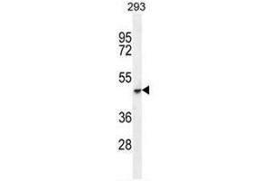 COCH Antibody (C-term) western blot analysis in 293 cell line lysates (35µg/lane). (COCH 抗体  (C-Term))