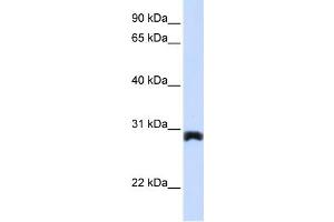 WB Suggested Anti-PEX11A Antibody Titration:  0. (PEX11A 抗体  (Middle Region))