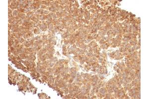 Immunohistochemistry (IHC) image for anti-Topoisomerase (DNA) I, Mitochondrial (TOP1MT) antibody (ABIN6939147)