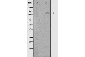 Western blot analysis of extracts of HepG2, using THBS1 antibody. (Thrombospondin 1 抗体  (Internal Region))