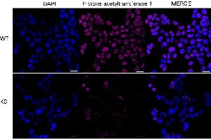 anti-Histone Acetyltransferase 1 (HAT1) antibody