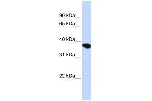 ST8SIA4 antibody used at 1 ug/ml to detect target protein. (ST8SIA4 抗体  (Middle Region))