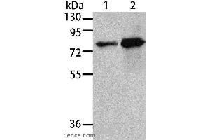 Western blot analysis of 293T and A431 cell, using MSN Polyclonal Antibody at dilution of 1:500 (Moesin 抗体)