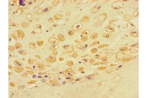 Immunohistochemistry of paraffin-embedded human placental tissue using ABIN7143102 at dilution of 1:100 (ACTR3 抗体  (AA 352-409))