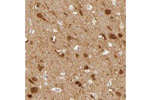 Immunohistochemical staining of human cerebral cortex with DLG3 polyclonal antibody  shows distinct nuclear and cytoplasmic positivity in neuronal cells at 1:50-1:200 dilution.