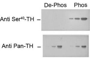 Image no. 1 for anti-Tyrosine Hydroxylase (TH) (pSer40) antibody (ABIN372738) (Tyrosine Hydroxylase 抗体  (pSer40))