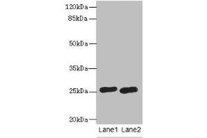 Western blot All lanes: RAB20 antibody at 0. (RAB2A 抗体  (AA 1-234))