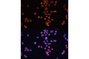 Immunofluorescence analysis of HT-29 cells using CDX2 antibody (ABIN3022281, ABIN3022282, ABIN3022283 and ABIN6218711) at dilution of 1:100. (CDX2 抗体  (AA 1-180))