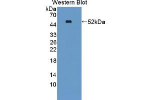 Western blot analysis of the recombinant protein. (Metabotropic Glutamate Receptor 1 抗体  (AA 165-592))