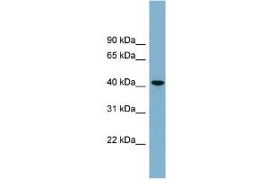 Western Blotting (WB) image for anti-UDP-Gal:betaGlcNAc beta 1,4- Galactosyltransferase, Polypeptide 2 (B4GALT2) (Middle Region) antibody (ABIN2781897)